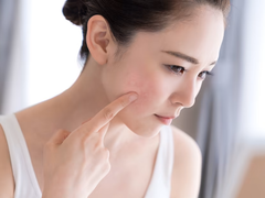 Skincare for sensitive skin at Barefection